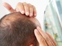 Ilustrasi seseorang memijat kulit kepala untuk merangsang pertumbuhan rambut di area botak.
